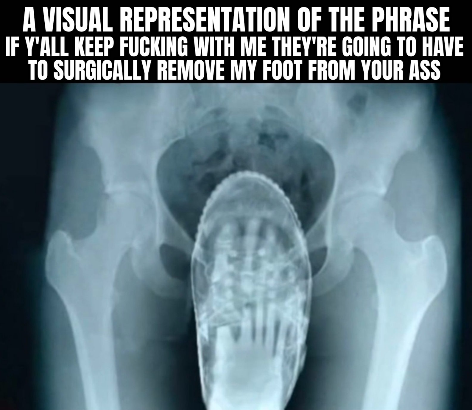 a meme of a picture of an xray that shows a foot embedded into someone's ass. The meme says, a visual representation of the phrase if you don't quit fucking with me, they are going to have to surgically remove my foot from your ass.